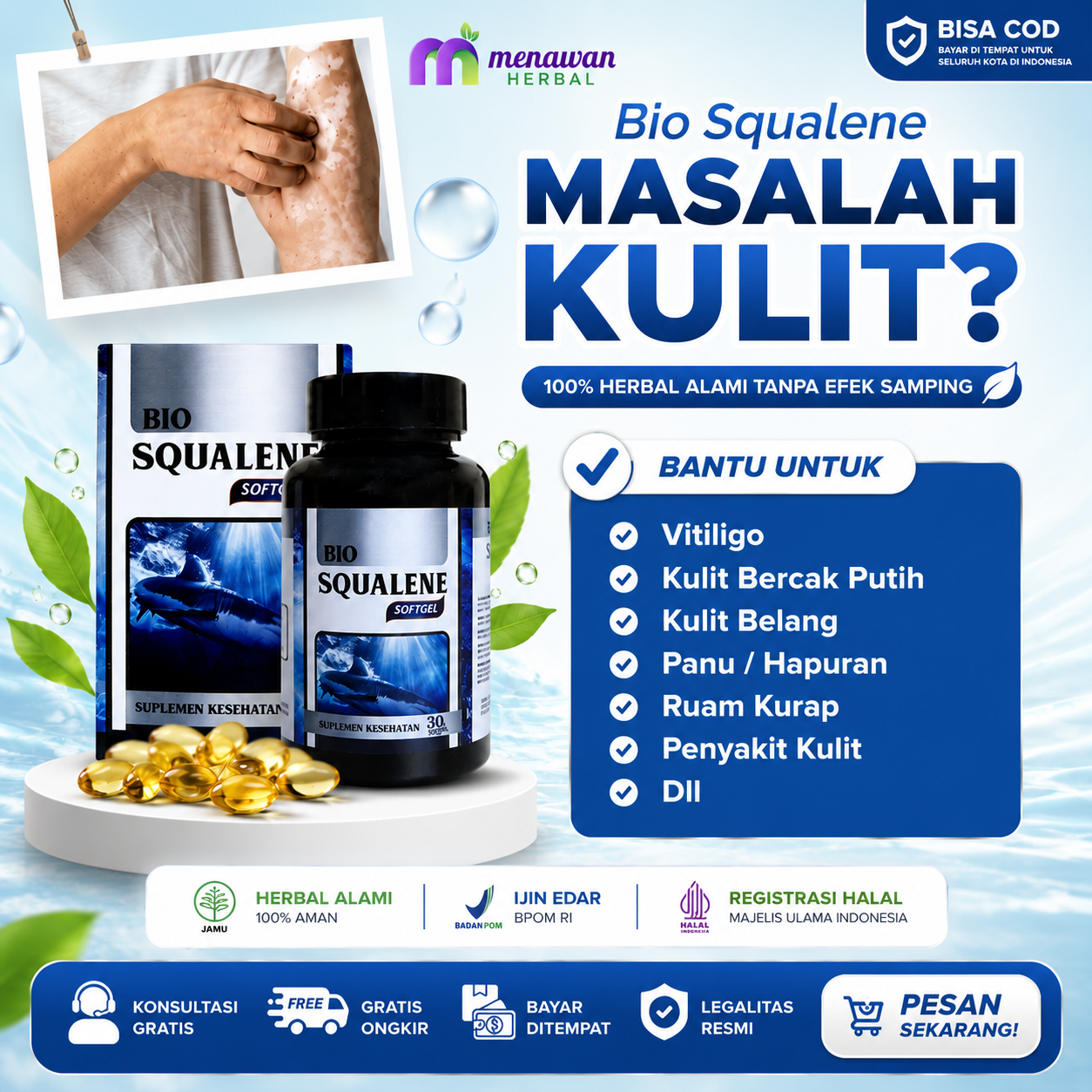Bio Squalene Untuk Kulit Vitiligo Bercak Putih Belang Isi 30 Softgel Sudah BPOM Halal MUI AMPUH NAMUN HASILNYA BERBEDA SETIAP ORANG